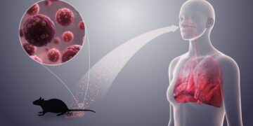 Why the CDC Activates Level 3 as WHO Tracks Hantavirus Across 11 Countries